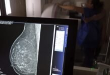 Médicos lançam guia para evitar recusa de mamografia digital Agência Brasil / EBC